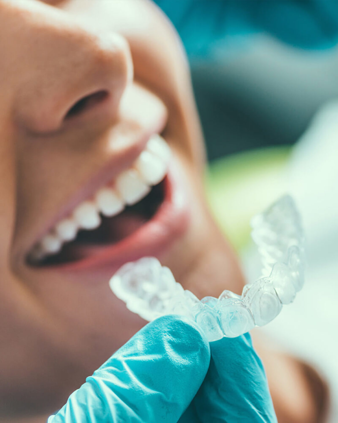 Tooth Whitening Package