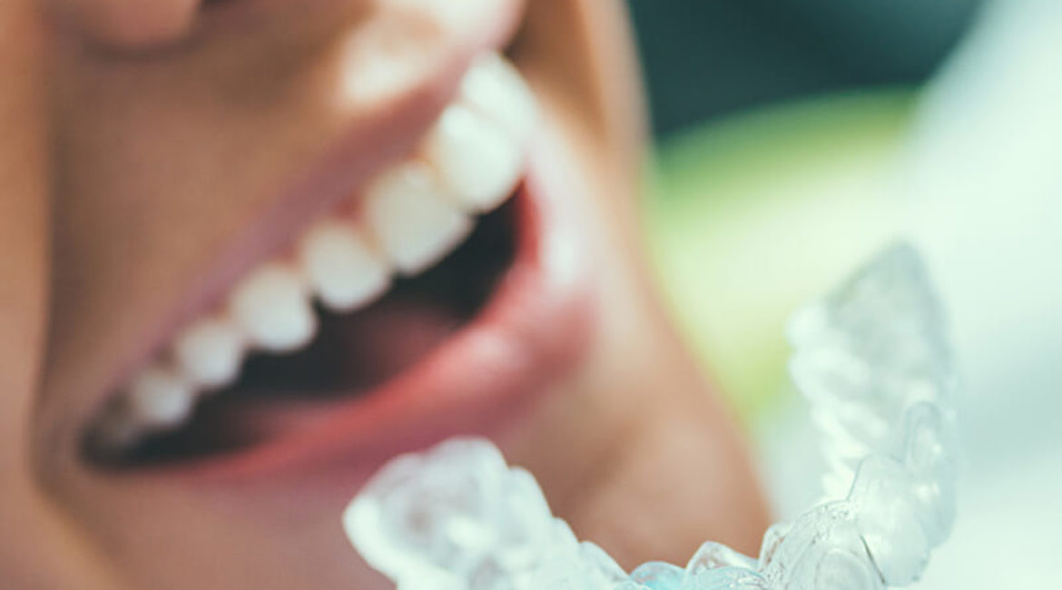 Tooth Whitening Package
