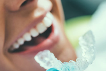 Tooth Whitening Package